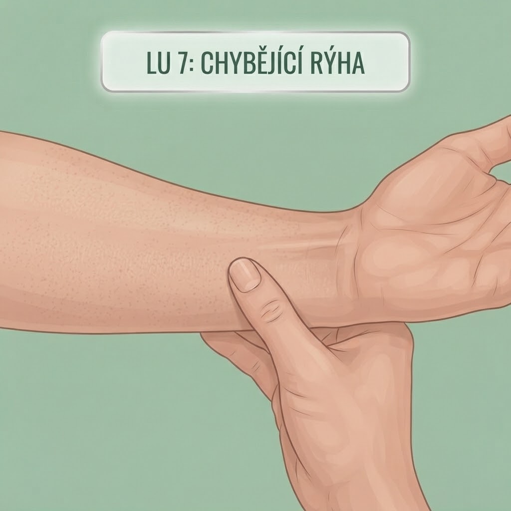 Chybéjící Rýha (LU 7)